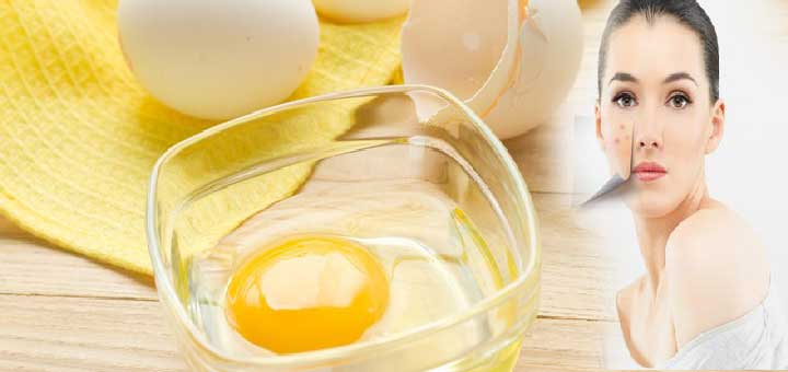 Yumurta Akı Maskesi Sonrası Dikkat Edilmesi Gereken Noktalar